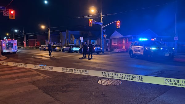 Victim assaulted in Toronto’s west end sustained large cuts during attack, police say